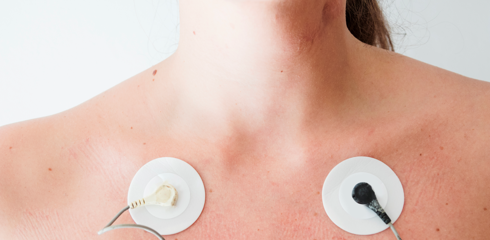Eletroterapia: Como funciona?