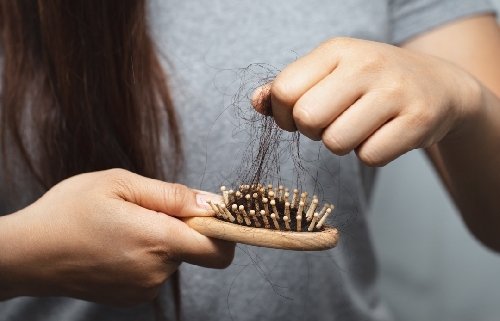 Entenda a Queda de Cabelo Feminina